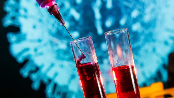 Коронавирусная инфекция: причины заболевания, основные симптомы, лечение и профилактика