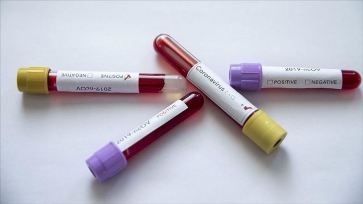 В Беларуси проведено более 81 тыс. тестов на коронавирус