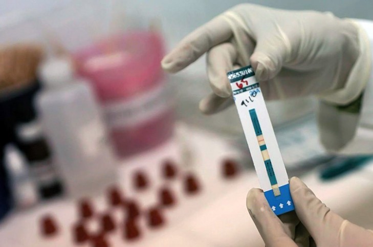 Тестирование на ВИЧ: для чего это нужно и как часто следует его делать