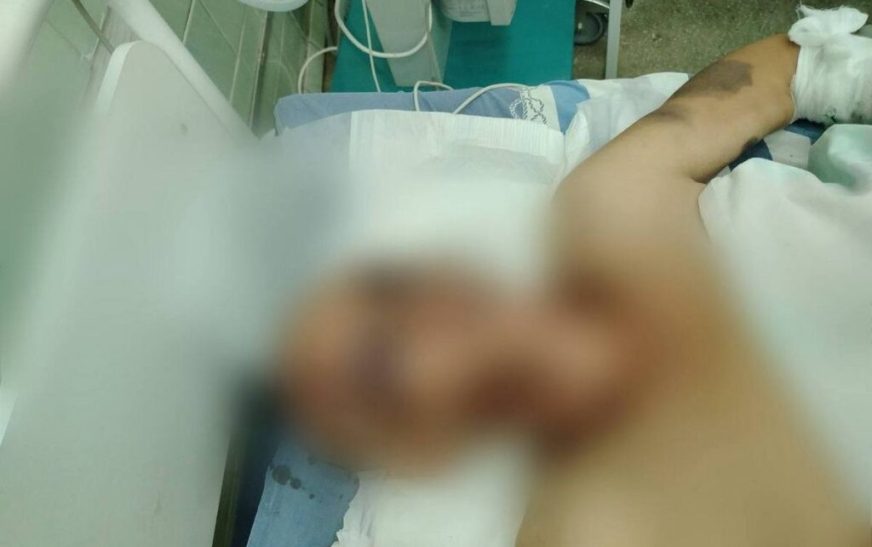Женщина в Слуцком районе скрывала побои, пока не попала в реанимацию